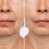 Crema Antienvejecimiento Resveratrol + Aceite Antiarrugas GRATIS ¡Transforma tu piel en solo 2 semanas! Nuestra crema con Resveratrol, Retinol y Niacinamida suaviza arrugas, hidrata profundamente y devuelve firmeza al rostro. Recibe de regalo el aceite reafirmante rejuvenecedor. 100% vegano