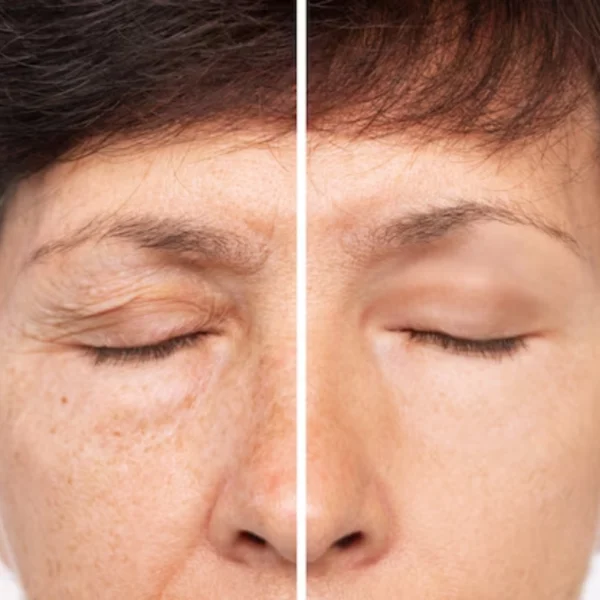 Crema Antienvejecimiento Resveratrol + Aceite Antiarrugas GRATIS ¡Transforma tu piel en solo 2 semanas! Nuestra crema con Resveratrol, Retinol y Niacinamida suaviza arrugas, hidrata profundamente y devuelve firmeza al rostro. Recibe de regalo el aceite reafirmante rejuvenecedor. 100% vegano